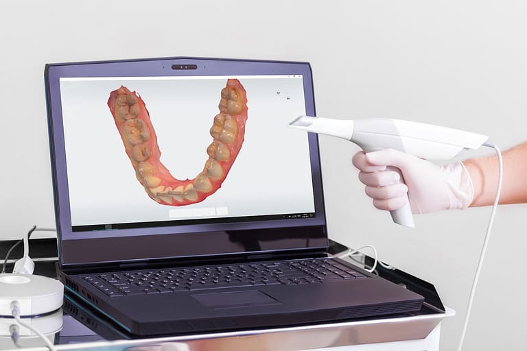 Digital dental impressions