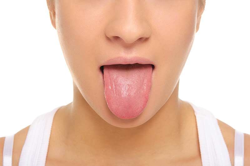 Myofunctional Therapy tongue exercises.