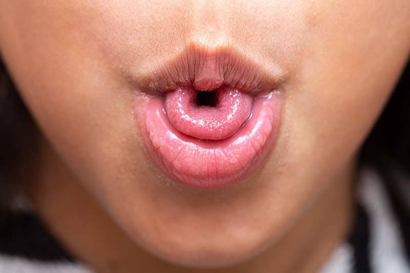 Person doing myofunctional therapy tongue exercises.