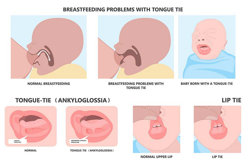 Myofunctional Therapy screening illustration.