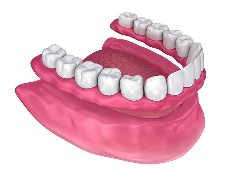 3D illustration of a complete denture.